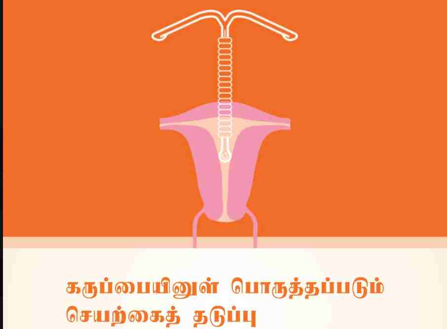 TB26_ IUD.pdf_11zon